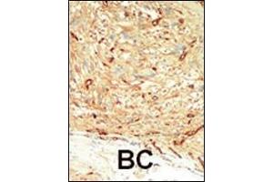 Immunohistochemistry (Paraffin-embedded Sections) (IHC (p)) image for anti-Macrophage Stimulating 1 (Hepatocyte Growth Factor-Like) (MST1) (AA 385-415), (C-Term) antibody (ABIN392427)