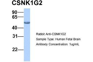 Host: Rabbit  Target Name: CSNK1G2  Sample Tissue: Human Fetal Brain  Antibody Dilution: 1. (Casein Kinase 1 gamma 2 抗体  (Middle Region))