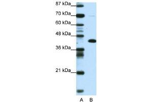 Transfected 293T; WB Suggested Anti-ZBTB25 Antibody Titration: 0. (ZBTB25 抗体  (Middle Region))