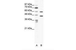 Image no. 1 for anti-Cation Channel, Sperm Associated 2 (CATSPER2) (C-Term) antibody (ABIN203196) (CATSPER2 抗体  (C-Term))