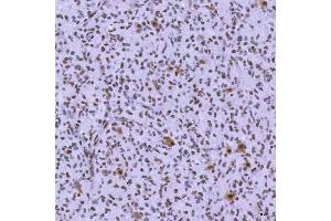 IHC analysis of SNRNP200 using anti-SNRNP200 antibody (ABIN7602032). (SNRNP200 抗体  (AA 557-2129))