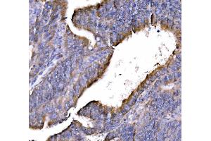 IHC analysis of GGA3 using anti-GGA3 antibody (ABIN7602337).