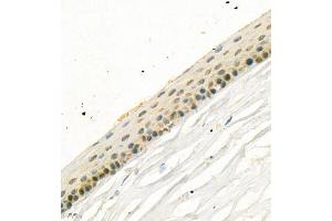 Immunohistochemistry of paraffin embedded rat eye using SLC7A14 (ABIN7075683) at dilution of 1:700 (400x lens) (SLC7A14 抗体)