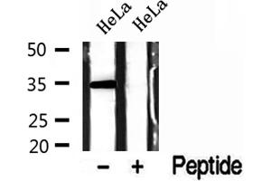 Western blot analysis of extracts of HeLa cells, using GOLPH3 antibody. (GOLPH3 抗体  (C-Term))