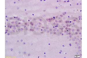 Formalin-fixed and paraffin embedded rat brain labeled with Anti-AMPK beta 1 Polyclonal Antibody, Unconjugated (ABIN737901) at 1:200 followed by conjugation to the secondary antibody and DAB staining. (PRKAB1 抗体  (AA 201-270))