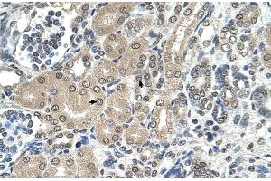 Immunohistochemistry (IHC) image for anti-Ribosomal RNA Processing 1 Homolog A (RRP1) (C-Term) antibody (ABIN2782369)