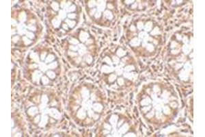 Immunohistochemistry of TEM2 in human colon tissue with this product at 2. (RASD2 抗体  (N-Term))