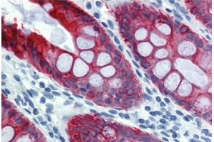 Immunohistochemistry staining of human colon (paraffin sections) using anti-cytokeratin 18 (clone DA-7). (Cytokeratin 18 抗体)