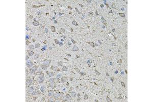 Immunohistochemistry of paraffin-embedded mouse brain using CDK10 antibody. (CDK10 抗体  (AA 1-283))