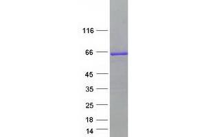Validation with Western Blot