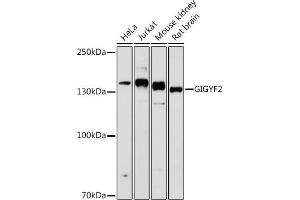 Western blot analysis of extracts of various cell lines, using GIGYF2 antibody (ABIN6132175, ABIN6141083, ABIN6141084 and ABIN6215640) at 1:1000 dilution. (GIGYF2 抗体  (AA 350-500))