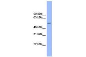 Image no. 1 for anti-Colony Stimulating Factor 1 (Macrophage) (CSF1) (AA 215-264) antibody (ABIN6743293) (M-CSF/CSF1 抗体  (AA 215-264))