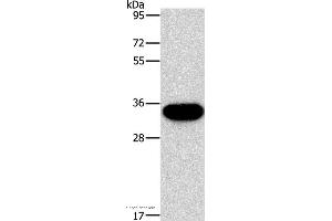 Western blot analysis of PC3 cell, using HOXB13 Polyclonal Antibody at dilution of 1:900 (HOXB13 抗体)