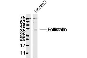 Lane 1: HCCLM3 lysates, probed with Follistatin Polyclonal Antibody, Unconjugated  at 1:300 dilution and 4˚Covernight incubation. (Follistatin 抗体  (AA 151-250))