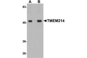 Western blot analysis of TMEM214 in rat brain tissue lysate with this product at (A) 1 and (B) 2 μg/ml. (TMEM214 抗体  (Center))