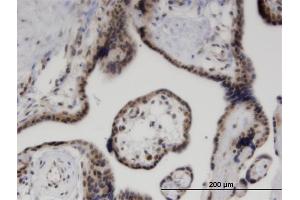 Immunoperoxidase of monoclonal antibody to ZNF232 on formalin-fixed paraffin-embedded human placenta. (ZNF232 抗体  (AA 181-280))