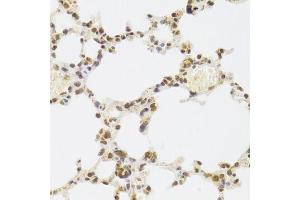 Immunohistochemistry of paraffin-embedded mouse lung using XRCC6 Antibody.