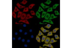 eEF2K Mouse Monoclonal Antibody staining HepG2 cells by IF/ICC. (EEF2K 抗体  (Internal Region))