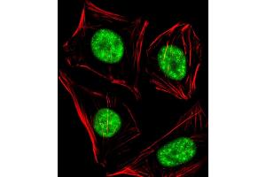 Immunofluorescent analysis of 4 % paraformaldehyde-fixed, 0. (RBBP5 抗体  (C-Term))