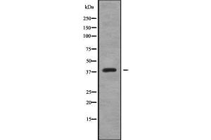 Western blot analysis of CREB3L4 using K562 whole cell lysates (CREB3L4 抗体  (Internal Region))