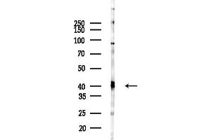 Western blot analysis of lysates from HUVEC cells(LPS 4h treatment), using SIA Antibody at 1/1000 dilution.