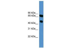 WB Suggested Anti-SYT16 Antibody Titration: 0. (SYT16 抗体  (N-Term))