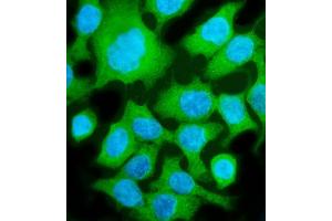 IF analysis of ALDOB using anti-ALDOB antibody (ABIN7602563). (ALDOB 抗体  (AA 85-364))