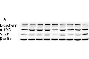 Downregulation of Snail1 reduced high glucose-induced EMT and TGF-β1 secretion in cultured HK2 cells. (SNAIL 抗体  (C-Term))