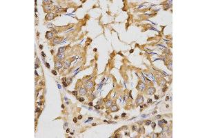 Immunohistochemistry (IHC) image for anti-Histone 3 (H3) (H3K27me) antibody (ABIN6219521)