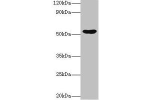 Western blot All lanes: EPHX1 antibody at 2 μg/mL + Hela whole cell lysate Secondary Goat polyclonal to rabbit IgG at 1/10000 dilution Predicted band size: 53 kDa Observed band size: 53 kDa (EPHX1 抗体  (AA 1-455))