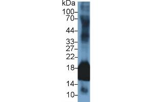 Detection of SOD1 in Rabbit Uterus lysate using Polyclonal Antibody to Superoxide Dismutase 1 (SOD1) (SOD1 抗体  (AA 2-153))