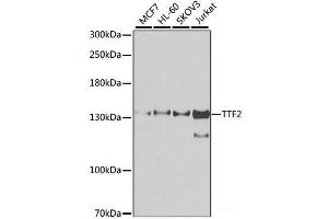 Western blot analysis of extracts of various cell lines using TTF2 Polyclonal Antibody at dilution of 1:1000. (TTF2 抗体)