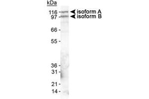 Western blot analysis of EPB41L3 in mouse brain lysate using EPB41L3 polyclonal antibody . (EPB41L3 抗体  (AA 400-500))