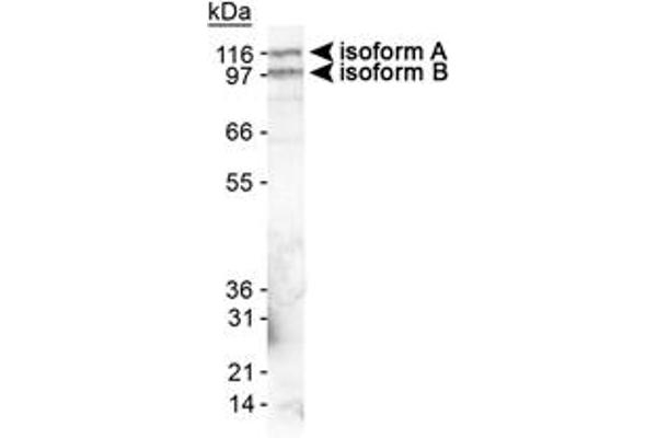 EPB41L3 抗体  (AA 400-500)