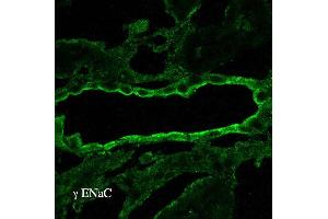 Immunohistochemistry analysis using Rabbit Anti-ENaC Polyclonal Antibody . (SCNN1A 抗体  (AA 629-650))