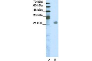 WB Suggested Anti-BUD31 Antibody Titration:  1. (BUD31 抗体  (Middle Region))