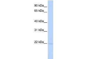 WB Suggested Anti-RER1 Antibody Titration:  0. (RER1 抗体  (Middle Region))