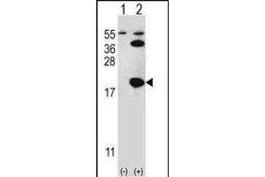Western blot analysis of UBE2I (arrow) using rabbit polyclonal UBE2I Antibody (S7) (ABIN387910 and ABIN2844306). (UBE2I 抗体  (N-Term))