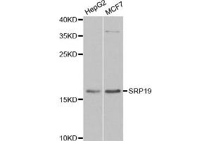 Western blot analysis of extracts of various cell lines, using SRP19 antibody. (SRP19 抗体)