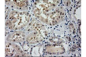 Immunohistochemical staining of paraffin-embedded Human Kidney tissue using anti-GSS mouse monoclonal antibody. (Glutathione Synthetase 抗体)