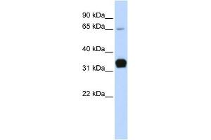 Troponin T Type 1 antibody used at 1 ug/ml to detect target protein. (TNNT1 抗体)