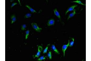 Immunofluorescent analysis of Hela cells using ABIN7147809 at dilution of 1:100 and Alexa Fluor 488-congugated AffiniPure Goat Anti-Rabbit IgG(H+L) (CMTM2 抗体  (AA 1-80))