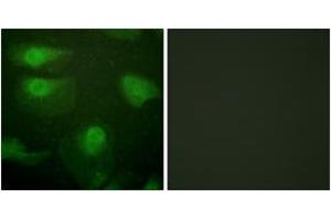Immunofluorescence analysis of HeLa cells, using CaMK1-alpha (Phospho-Thr177) Antibody. (CAMK1 抗体  (pThr177))