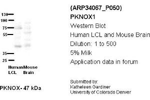 Image no. 2 for anti-PBX/knotted 1 Homeobox 1 (PKNOX1) (Middle Region) antibody (ABIN2778247) (PKNOX1 抗体  (Middle Region))
