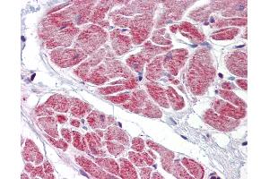 Anti-NANOS1 antibody IHC of human heart. (Nanos Homolog 1 抗体  (AA 50-100))