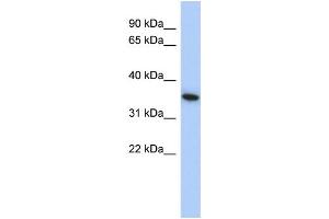WB Suggested Anti-MXI1 Antibody Titration: 0. (MXI1 抗体  (Middle Region))
