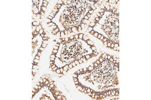 Immunohistochemical analysis of paraffin-embedded human small intestine tissue using (ABIN656961 and ABIN2846145) performed on the Leica® BOND RXm. (CLMP 抗体  (AA 81-110))