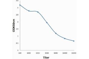 Antigen: 0. (CEA 抗体  (AA 315-365))