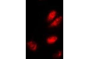 Immunofluorescent analysis of ASF1A staining in A549 cells. (ASF1A 抗体)