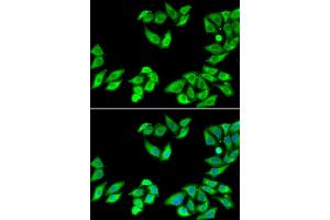 Immunofluorescence analysis of MCF7 cell using RPS14 antibody. (RPS14 抗体)